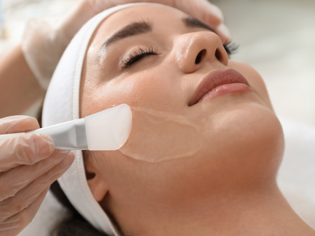 Chemical Peel