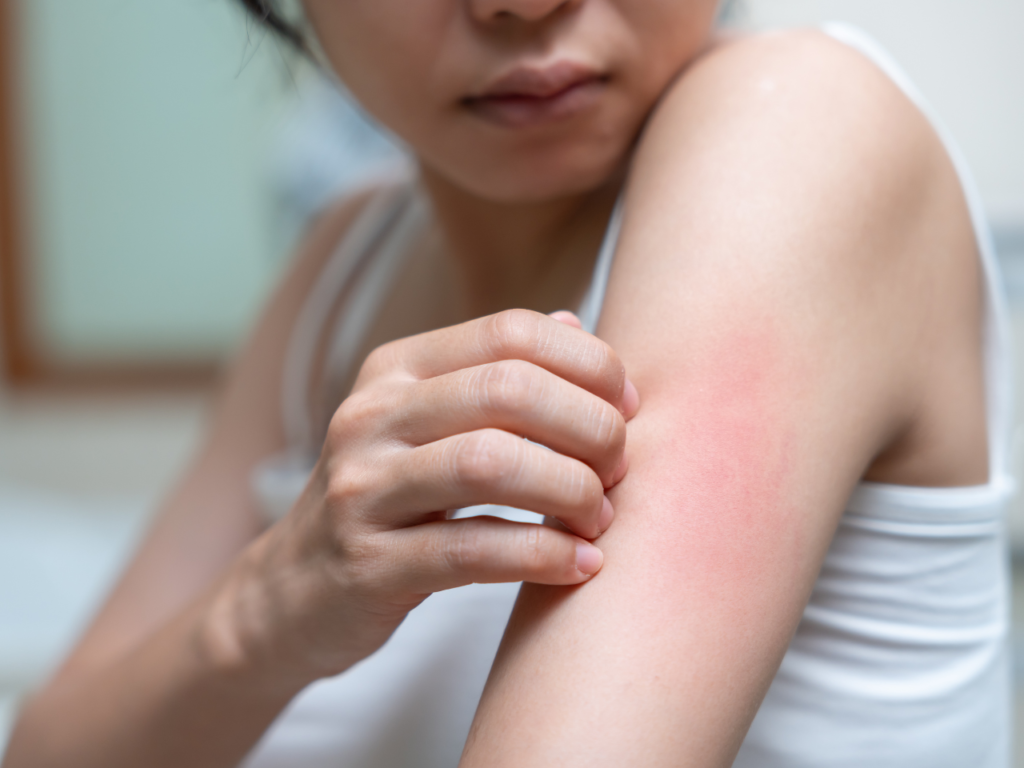 Fungal & Skin Infections