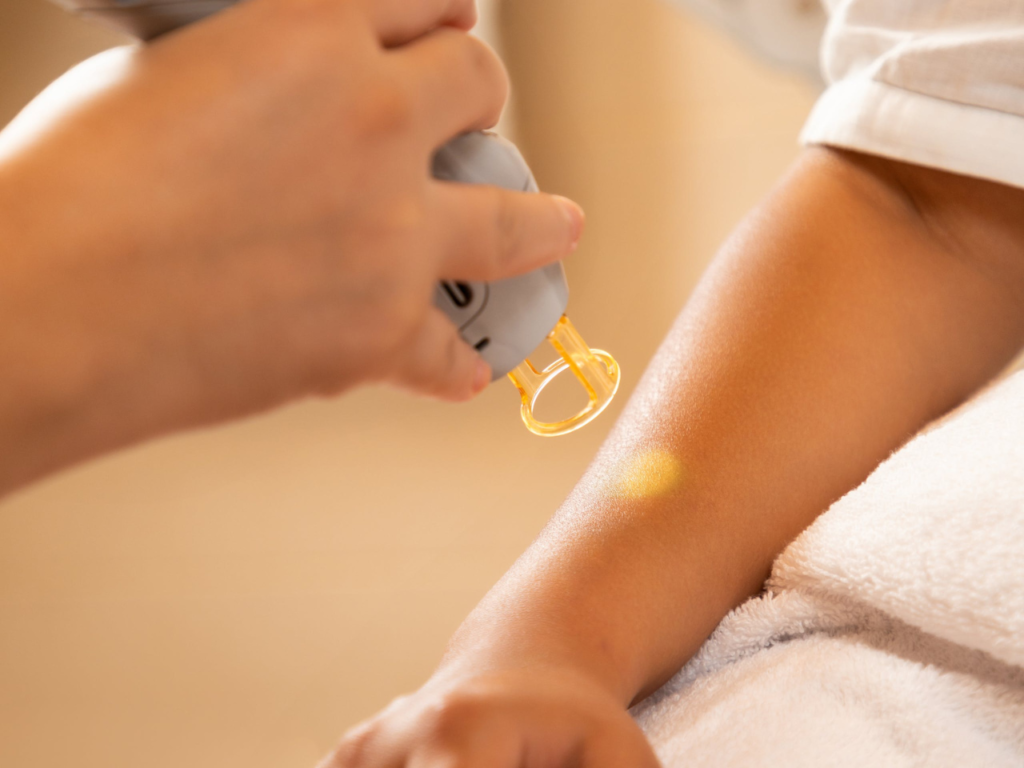 Tattoo & Hair Removal